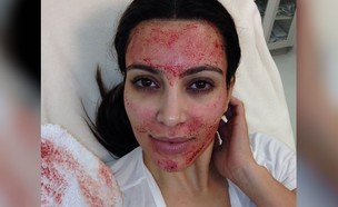 טיפול ואמפייר (צילום: kimkardashian, instagram)